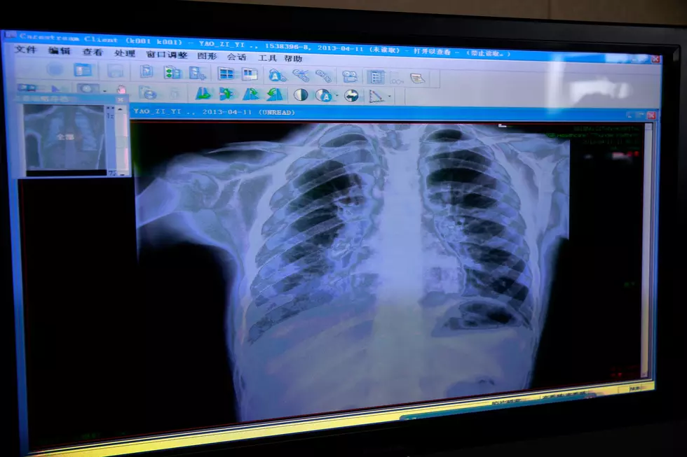 Two Children Have Died from This Extremely Contagious Illness in New York